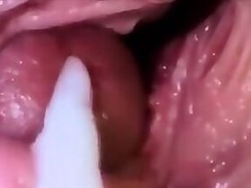 Impregnation
